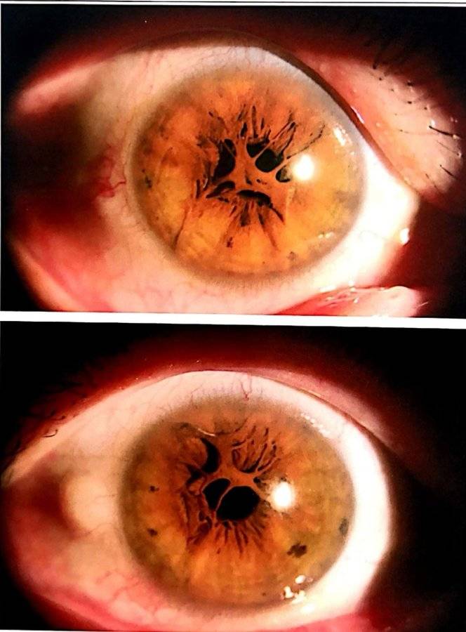 甘肃省医师协会第十届眼科医师大会暨"康哲杯"中国眼